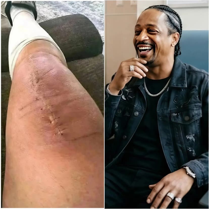 GOOD NEWS from Katt Williams: A heartfelt message after surgery 💬 “I still have a long road ahead. But I believe in healing — through love, through truth, and through the prayers from all of you.”